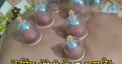 cupping therapy ke fayde, cupping therapy ke fayde aur nuksan, cupping therapy ke fayde in hindi, fire cupping therapy ke fayde, face cupping therapy ke fayde, cupping therapy ke kya fayde hain, cupping therapy karne ke fayde, cupping therapy use, cupping therapy benefits hindi, hijama cupping therapy ke fayde, hijama therapy ke fayde aur nuksan, cupping therapy benefits and side effects, cupping therapy kya hai, benefits of cup therapy, benefits of cupping therapy, what is benefits of cupping therapy, dry cupping therapy ke fayde, cupping therapy in pakistan, cupping therapy full course, cup therapy ke fayde, benefits of cupping therapy in hindi, benefit of cup therapy, cupping therapy benefits on face, benefits of dry cupping therapy, cup therapy ke fayde kya hai, cup therapy ke kya fayde hote hain, hijama therapy ke fayde in hindi islam, hijama therapy ke fayde in hindi hair, hijama therapy ke fayde, health benefits of cupping therapy, hijama therapy ke fayde in urdu, hijama therapy ke fayde in telugu, cupping therapy kis liye hota hai, cup therapy karne ke fayde, what is the benefit of cupping therapy, is cupping good or bad, cupping therapy vs hijama, cupping therapy full process, uses of cupping therapy, what is cupping therapy hindi, cupping therapy kit online, what is the benefits of cupping therapy