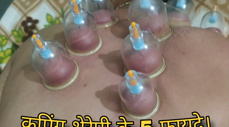 cupping therapy ke fayde, cupping therapy ke fayde aur nuksan, cupping therapy ke fayde in hindi, fire cupping therapy ke fayde, face cupping therapy ke fayde, cupping therapy ke kya fayde hain, cupping therapy karne ke fayde, cupping therapy use, cupping therapy benefits hindi, hijama cupping therapy ke fayde, hijama therapy ke fayde aur nuksan, cupping therapy benefits and side effects, cupping therapy kya hai, benefits of cup therapy, benefits of cupping therapy, what is benefits of cupping therapy, dry cupping therapy ke fayde, cupping therapy in pakistan, cupping therapy full course, cup therapy ke fayde, benefits of cupping therapy in hindi, benefit of cup therapy, cupping therapy benefits on face, benefits of dry cupping therapy, cup therapy ke fayde kya hai, cup therapy ke kya fayde hote hain, hijama therapy ke fayde in hindi islam, hijama therapy ke fayde in hindi hair, hijama therapy ke fayde, health benefits of cupping therapy, hijama therapy ke fayde in urdu, hijama therapy ke fayde in telugu, cupping therapy kis liye hota hai, cup therapy karne ke fayde, what is the benefit of cupping therapy, is cupping good or bad, cupping therapy vs hijama, cupping therapy full process, uses of cupping therapy, what is cupping therapy hindi, cupping therapy kit online, what is the benefits of cupping therapy