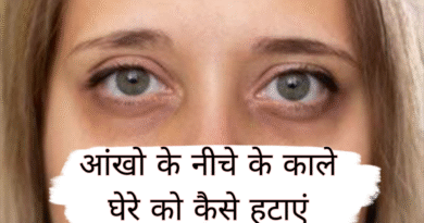 dark circles remedies, aankhon ki jhalak, home remedies for dark circles, dark circle treatment tips, natural ways to remove dark circles, under eye care routine, dark circles makeup tips, sleep and dark circles, eye cream for dark circles, dark circles causes and solutions