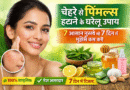 चेहरे से पिंपल्स हटाने के घरेलू उपाय: 7 आसान नुस्खे जो 7 दिन में मुंहासे कम करें face pimples home remedies, remove pimples naturally, acne treatment at home, home remedies for pimples