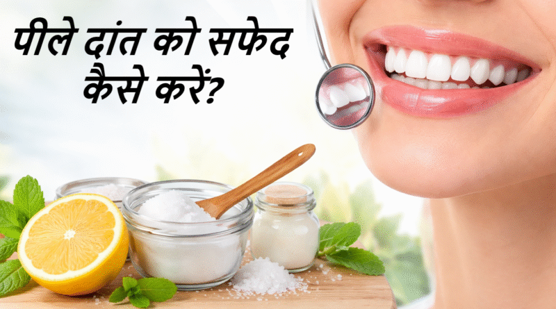 peele dant safed kaise kare, teeth whitening tips hindi, daant safed karne ke gharelu upay, yellow teeth solution, natural teeth whitening, teeth cleaning tips, oral hygiene tips, dant safed karne ke tareeke