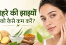 चेहरे की झाइयों को कैसे कम करें? आसान घरेलू उपाय और असरदार टिप्स चेहरे की झाइयां कैसे कम करें