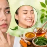 चेहरे की फुंसियां कैसे ठीक करें? जानिए असरदार घरेलू नुस्खे और बचाव के आसान तरीके