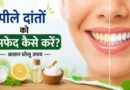 पीले दांतों को सफेद कैसे करें? जानें आसान घरेलू उपाय और बचाव के तरीके