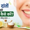 पीले दांतों को सफेद कैसे करें? जानें आसान घरेलू उपाय और बचाव के तरीके