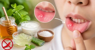 मुंह के छाले ठीक करने के घरेलू उपाय: दर्द और जलन से राहत पाने के आसान तरीके
