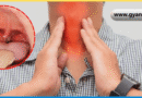 Tonsils Meaning in Hindi, टॉन्सिल क्या है, टॉन्सिल के लक्षण, टॉन्सिल का घरेलू इलाज, टॉन्सिल में क्या खाएं, Tonsils Symptoms in Hindi, गले के टॉन्सिल, टॉन्सिल दर्द का उपाय