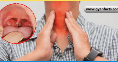 Tonsils Meaning in Hindi, टॉन्सिल क्या है, टॉन्सिल के लक्षण, टॉन्सिल का घरेलू इलाज, टॉन्सिल में क्या खाएं, Tonsils Symptoms in Hindi, गले के टॉन्सिल, टॉन्सिल दर्द का उपाय