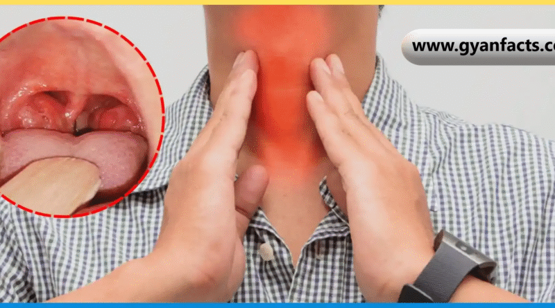 Tonsils Meaning in Hindi, टॉन्सिल क्या है, टॉन्सिल के लक्षण, टॉन्सिल का घरेलू इलाज, टॉन्सिल में क्या खाएं, Tonsils Symptoms in Hindi, गले के टॉन्सिल, टॉन्सिल दर्द का उपाय