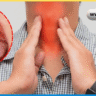 Tonsils Meaning in Hindi, टॉन्सिल क्या है, टॉन्सिल के लक्षण, टॉन्सिल का घरेलू इलाज, टॉन्सिल में क्या खाएं, Tonsils Symptoms in Hindi, गले के टॉन्सिल, टॉन्सिल दर्द का उपाय