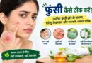 फुंसी कैसे ठीक करें, फुंसी कैसे सही करें, चेहरे की फुंसी कैसे हटाएं, फुंसी का घरेलू उपाय, फुंसी का इलाज, चेहरे पर फुंसी क्यों होती है, फुंसी जल्दी कैसे ठीक करें, दर्द वाली फुंसी कैसे ठीक करें, फुंसी में क्या लगाएं, फुंसी होने के कारण, चेहरे के दाने कैसे ठीक करें, मुंहासे कैसे ठीक करें, पिंपल कैसे हटाएं, pimple kaise thik kare, funsi kaise thik kare, pimple treatment in hindi