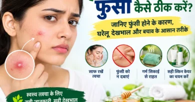 फुंसी कैसे ठीक करें, फुंसी कैसे सही करें, चेहरे की फुंसी कैसे हटाएं, फुंसी का घरेलू उपाय, फुंसी का इलाज, चेहरे पर फुंसी क्यों होती है, फुंसी जल्दी कैसे ठीक करें, दर्द वाली फुंसी कैसे ठीक करें, फुंसी में क्या लगाएं, फुंसी होने के कारण, चेहरे के दाने कैसे ठीक करें, मुंहासे कैसे ठीक करें, पिंपल कैसे हटाएं, pimple kaise thik kare, funsi kaise thik kare, pimple treatment in hindi